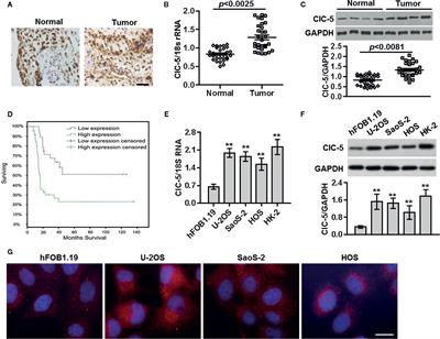 ClC-5 Downregulation Induces Osteosarcoma Cell Apoptosis by Promoting Bax and tBid Complex Formation